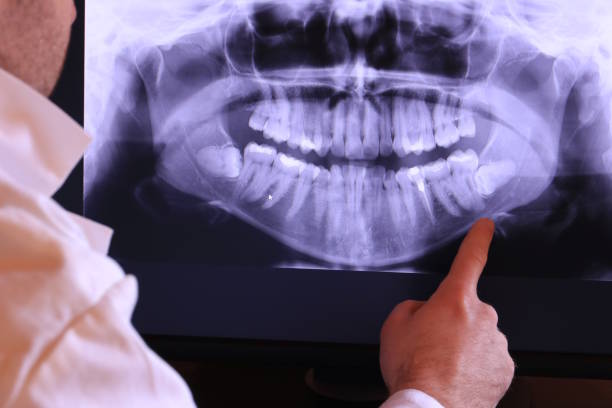 Best Urgent Care for Lost Fillings or Crowns in Brambleton, VA