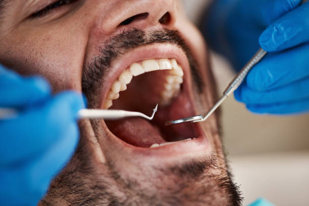 Best Emergency Dental Care for Broken or Chipped Teeth in Brambleton, VA