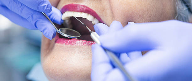 Best Emergency Tooth Extraction in Brambleton, VA